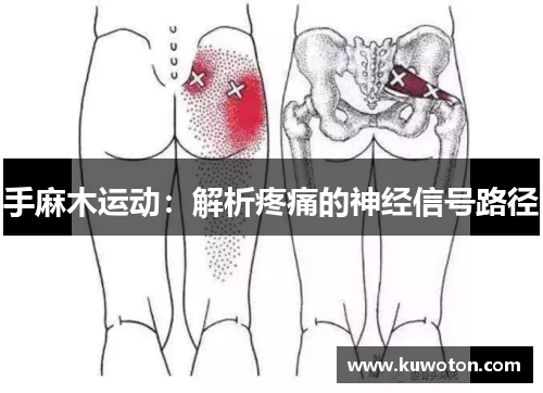 手麻木运动：解析疼痛的神经信号路径